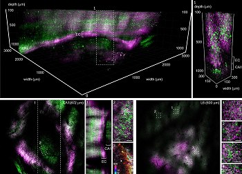 Profundoscpio, o microscpio que promete revolucionar a neurocincia